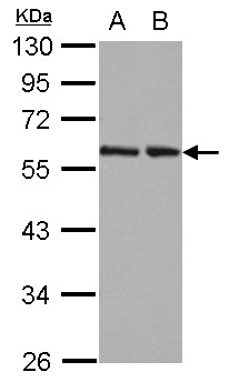 RAD23B / HR23B Antibody - Sample (30 ug of whole cell lysate) A: 293T B: A431 12% SDS PAGE RAD23B antibody diluted at 1:10000
