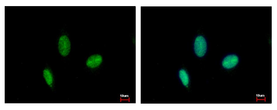RAD23B / HR23B Antibody - RAD23B antibody detects RAD23B protein at nucleus by immunofluorescent analysis. HeLa cells were fixed in 4% paraformaldehyde at RT for 15 min. RAD23B protein stained by RAD23B antibody diluted at 1:500.