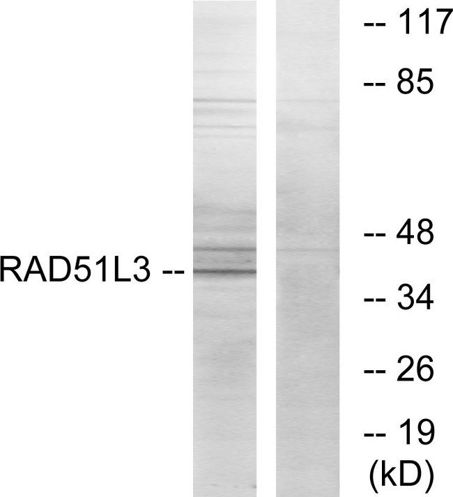 RAD51L3 / RAD51D Antibody - Western blot analysis of lysates from Jurkat cells, using RAD51L3 Antibody. The lane on the right is blocked with the synthesized peptide.