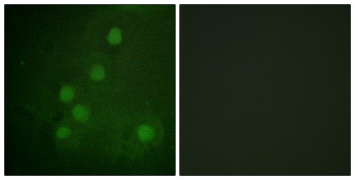 RAD52 Antibody - Immunofluorescence analysis of COS7 cells, using RAD52 Antibody. The picture on the right is blocked with the synthesized peptide.