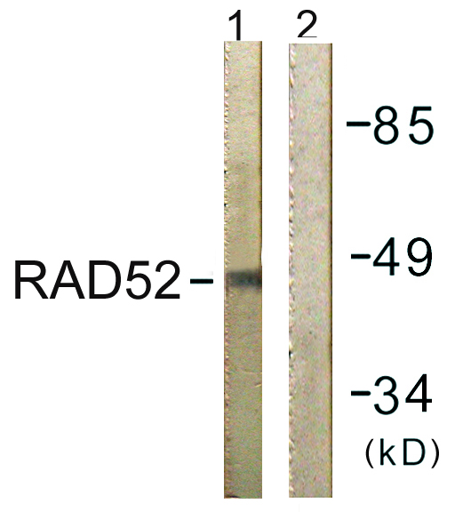 RAD52 Antibody - Western blot analysis of lysates from 293 cells, using RAD52 Antibody. The lane on the right is blocked with the synthesized peptide.