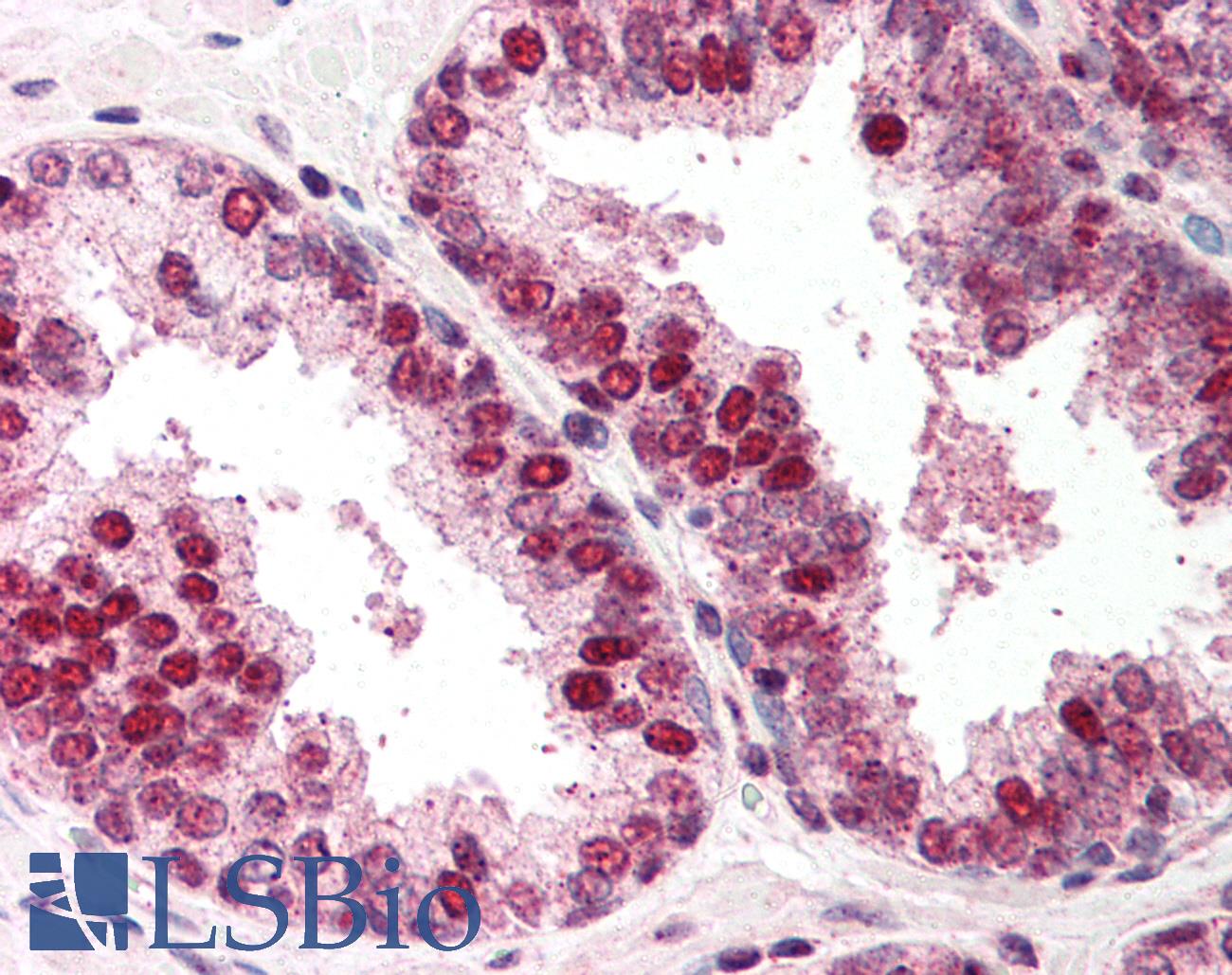 RAD52 Antibody - Anti-RAD52 antibody IHC of human prostate. Immunohistochemistry of formalin-fixed, paraffin-embedded tissue after heat-induced antigen retrieval. Antibody concentration 5 ug/ml.