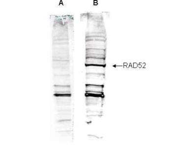 RAD52 Antibody - Anti-Human RAD52 Antibody - Western Blot. Western blot analysis is shown using Affinity Purified anti-Human RAD52 antibody to detect Human RAD52 present in a HeLa nuclear extract (panel B). ~30 ug of lysate was loaded per lane for 4-20% gradient SDS-PAGE. Comparison to a molecular weight marker (not shown) indicates a band of ~63.0 kD is detected. Peptide competition (panel A) blocks the specific staining of this band. The blot was incubated with a 1:1000 dilution of the antibody at room temperature for 2 h followed by detection using IRDye800 labeled Goat-a-Rabbit IgG [H&L] ( diluted 1:5000 for 45 min. IRDye800 fluorescence image was captured using the Odyssey Infrared Imaging System developed by.
