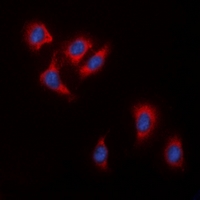 RAF1 / RAF Antibody - Immunofluorescent analysis of c-RAF staining in HeLa cells. Formalin-fixed cells were permeabilized with 0.1% Triton X-100 in TBS for 5-10 minutes and blocked with 3% BSA-PBS for 30 minutes at room temperature. Cells were probed with the primary antibody in 3% BSA-PBS and incubated overnight at 4 deg C in a humidified chamber. Cells were washed with PBST and incubated with a DyLight 594-conjugated secondary antibody (red) in PBS at room temperature in the dark. DAPI was used to stain the cell nuclei (blue).