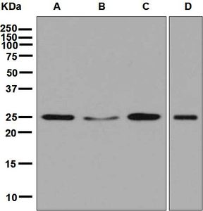 RALA / RAL Antibody - Western blot analysis on (A) MCF-7, (B) Molt-4, (C) BxPC-3, and (D) HepG2 cell lysates using anti-RALA antibody at a 1:1000 dilution.