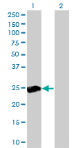 RALB Antibody - Western blot of RALB expression in transfected 293T cell line by RALB monoclonal antibody clone 4D1.