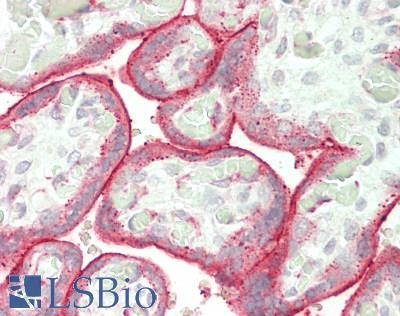 RALDH2 / ALDH1A2 Antibody - Human Placenta: Formalin-Fixed, Paraffin-Embedded (FFPE)