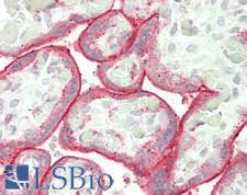 RALDH2 / ALDH1A2 Antibody - Human Placenta: Formalin-Fixed, Paraffin-Embedded (FFPE)
