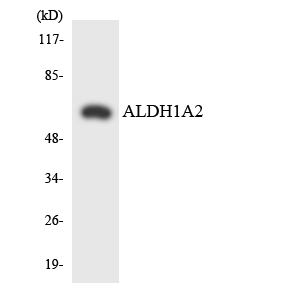 RALDH2 / ALDH1A2 Antibody - Western blot analysis of the lysates from COLO205 cells using ALDH1A2 antibody.