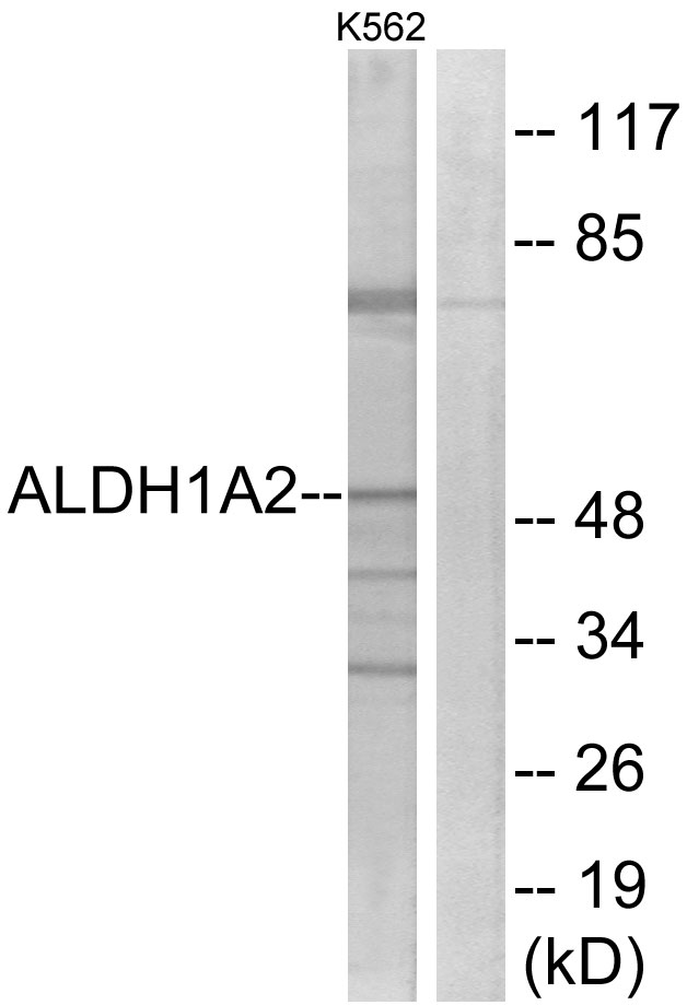 RALDH2 / ALDH1A2 Antibody - Western blot analysis of lysates from K562 cells, using ALDH1A2 Antibody. The lane on the right is blocked with the synthesized peptide.