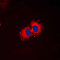 RALDH2 / ALDH1A2 Antibody - Immunofluorescent analysis of ALDH1A2 staining in HepG2 cells. Formalin-fixed cells were permeabilized with 0.1% Triton X-100 in TBS for 5-10 minutes and blocked with 3% BSA-PBS for 30 minutes at room temperature. Cells were probed with the primary antibody in 3% BSA-PBS and incubated overnight at 4 C in a humidified chamber. Cells were washed with PBST and incubated with a DyLight 594-conjugated secondary antibody (red) in PBS at room temperature in the dark. DAPI was used to stain the cell nuclei (blue).