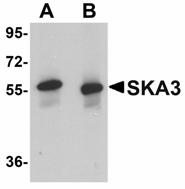 RAMA1 / SKA3 Antibody - Western blot of SKA3 in human testis tissue lysate with SKA3 antibody at (A) 0.5 and (B) 1 ug/ml.