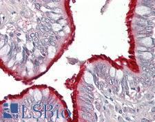 RAMP2 Antibody - Human Lung: Formalin-Fixed, Paraffin-Embedded (FFPE)