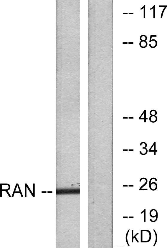 RAN Antibody - Western blot analysis of lysates from LOVO cells, using RAN Antibody. The lane on the right is blocked with the synthesized peptide.
