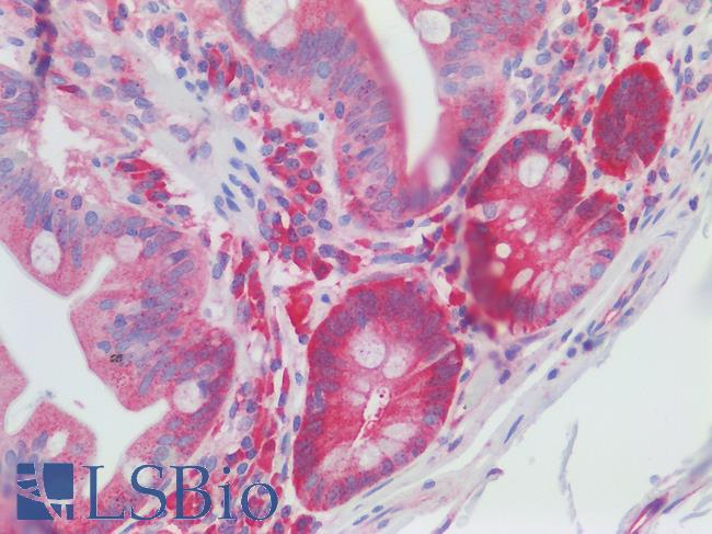 RANBP1 Antibody - Human Small Intestine: Formalin-Fixed, Paraffin-Embedded (FFPE)