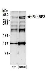 RANBP2 / TRP1 Antibody - Detection of mouse RanBP2 by western blot. Samples: Whole cell lysate (50 µg) from NIH 3T3 and TCMK-1 cells prepared using NETN lysis buffer. Antibody: Affinity purified rabbit anti-RanBP2 antibody used for WB at 1 µg/ml. Detection: Chemiluminescence with an exposure time of 30 seconds.