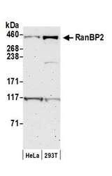 RANBP2 / TRP1 Antibody - Detection of human RanBP2 by western blot. Samples: Whole cell lysate (50 µg) from HeLa and HEK293T cells prepared using NETN lysis buffer. Antibody: Affinity purified rabbit anti-RanBP2 antibody used for WB at 0.1 µg/ml. Detection: Chemiluminescence with an exposure time of 3 minutes.