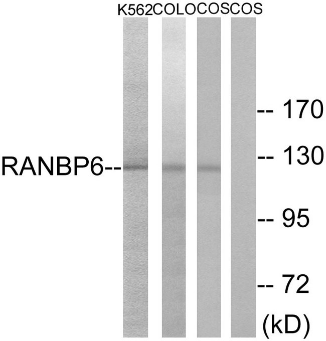 RANBP6 Antibody - Western blot analysis of lysates from COS7, K562, and COLO cells, using RANBP6 Antibody. The lane on the right is blocked with the synthesized peptide.