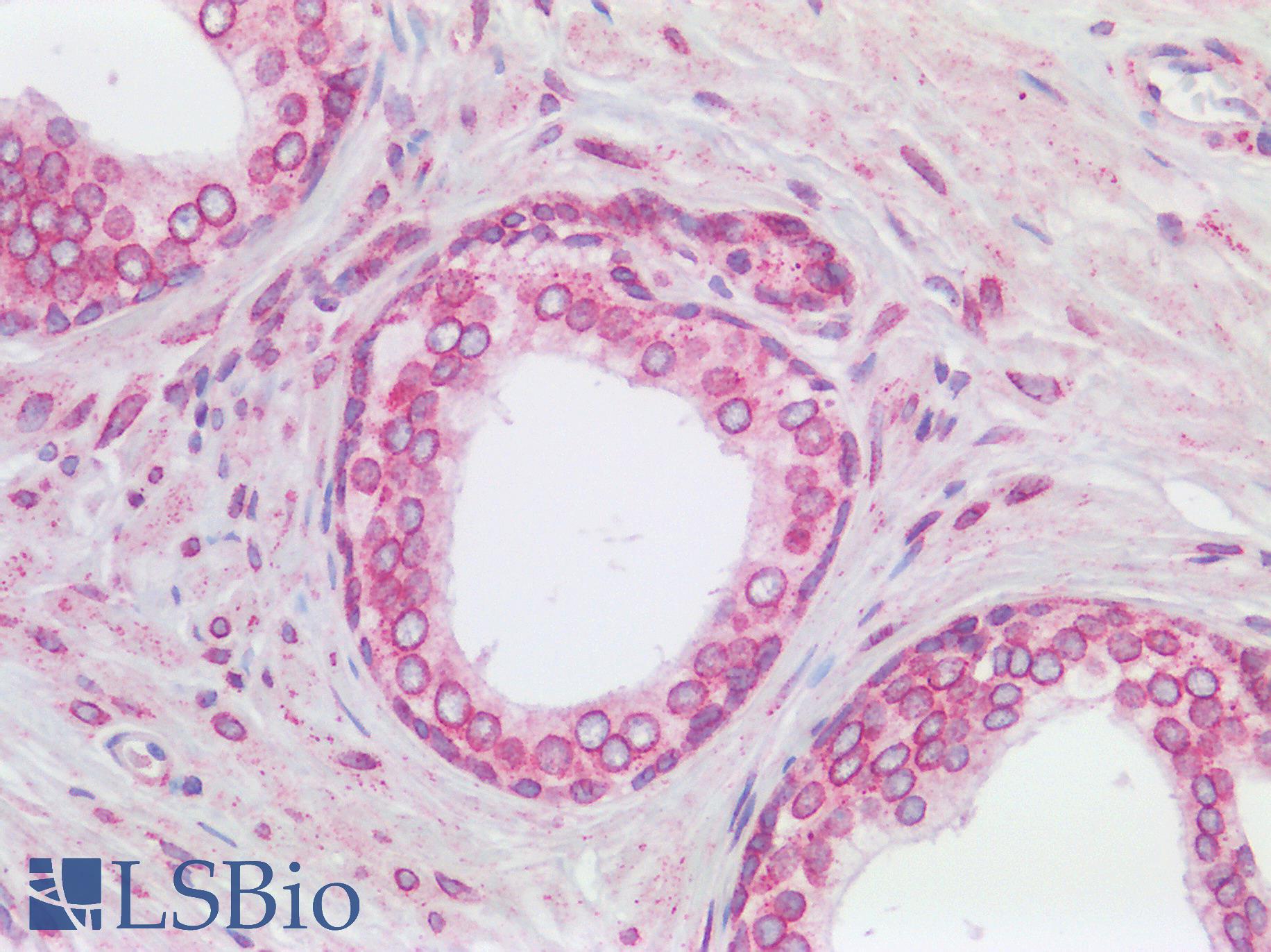 RANGAP1 Antibody - Human Prostate: Formalin-Fixed, Paraffin-Embedded (FFPE)