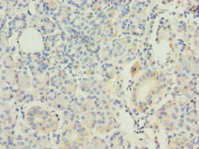 RAP1A Antibody - Immunohistochemistry of paraffin-embedded human pancreatic tissue using antibody at dilution of 1:100.