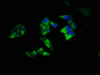 RAP1A Antibody - Immunofluorescence staining of Hela cells with RAP1A Antibody at 1:200, counter-stained with DAPI. The cells were fixed in 4% formaldehyde, permeabilized using 0.2% Triton X-100 and blocked in 10% normal Goat Serum. The cells were then incubated with the antibody overnight at 4°C. The secondary antibody was Alexa Fluor 488-congugated AffiniPure Goat Anti-Rabbit IgG(H+L).