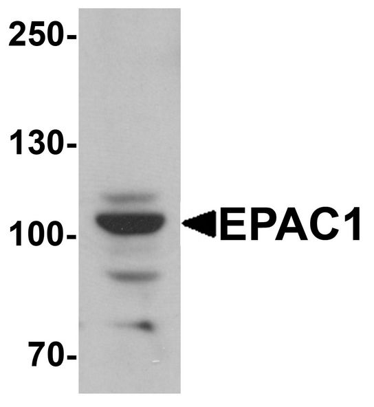 RAPGEF3 / EPAC Antibody - Western blot analysis of EPAC1 in rat skeletal muscle tissue lysate with EPAC1 antibody at 1 ug/ml.