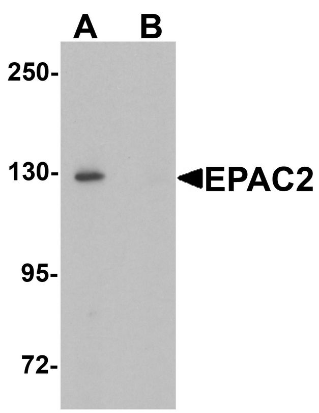 RAPGEF4 / EPAC2 Antibody - Western blot analysis of EPAC2 in rat liver tissue lysate with EPAC2 antibody at 1 ug/ml in (A) the absence and (B) the presence of blocking peptide.