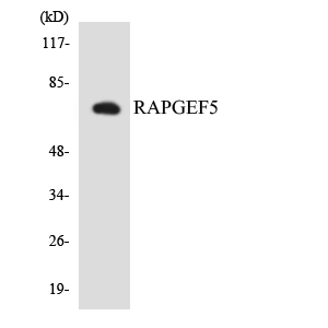 RAPGEF5 / GFR Antibody - Western blot analysis of the lysates from COLO205 cells using RAPGEF5 antibody.