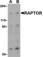 Raptor / Mip1 Antibody - Western blot of Raptor in L1210 cell lysate with aptor / Mip1 Antibody at (A) 2 and (B) 4 ug/ml.