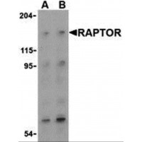 Raptor / Mip1 Antibody - Western blot analysis of Raptor in L1210 cell lysate with Raptor (IN) antibody at (A) 2 and (B) 4 µg/mL.