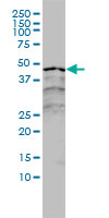 RARA / RAR Alpha Antibody - RARA monoclonal antibody clone 2C9-1F8 Western blot of RARA expression in A-431.