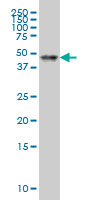 RARA / RAR Alpha Antibody - RARA monoclonal antibody clone 2D2 Western blot of RARA expression in HeLa NE.