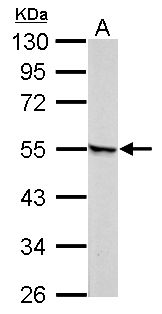 RARG / RAR-Gamma Antibody - Retinoic Acid Receptor gamma antibody detects RARG protein by Western blot analysis. A. 30 ug Neuro2A whole cell lysate/extract10 % SDS-PAGE Retinoic Acid Receptor gamma antibody  dilution: 1:1000