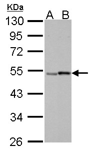 RARG / RAR-Gamma Antibody - Retinoic Acid Receptor gamma antibody detects RARG protein by Western blot analysis.A. 30 ug A549 whole cell lysate/extract. 30 ug HCT116 whole cell lysate/extract 10% SDS-PAGE Retinoic Acid Receptor gamma antibody  dilution: 1:1000