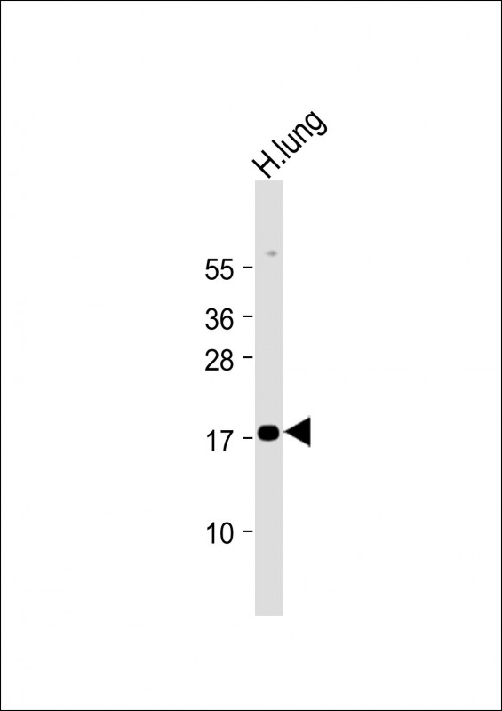 RARRES2 / Chemerin Antibody - Anti-RARRES2 Antibody (N-Term) at 1:2000 dilution + Human lung lysate Lysates/proteins at 20 µg per lane. Secondary Goat Anti-Rabbit IgG, (H+L), Peroxidase conjugated at 1/10000 dilution. Predicted band size: 19 kDa Blocking/Dilution buffer: 5% NFDM/TBST.
