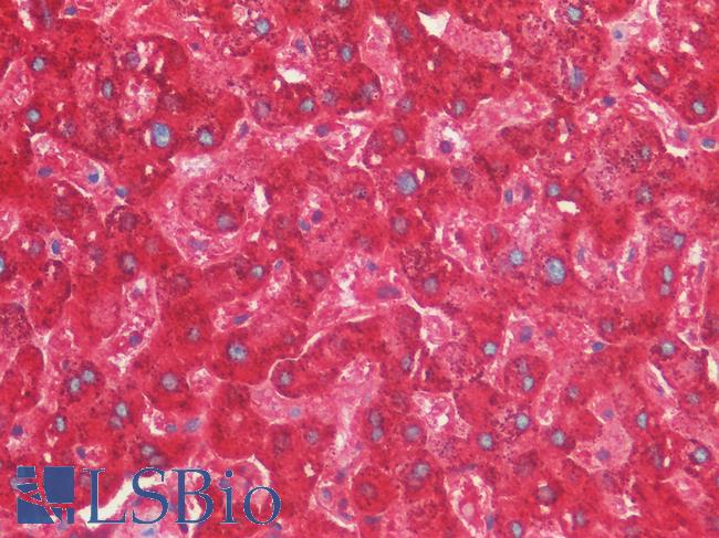 RARRES2 / Chemerin Antibody - Human Liver: Formalin-Fixed, Paraffin-Embedded (FFPE)