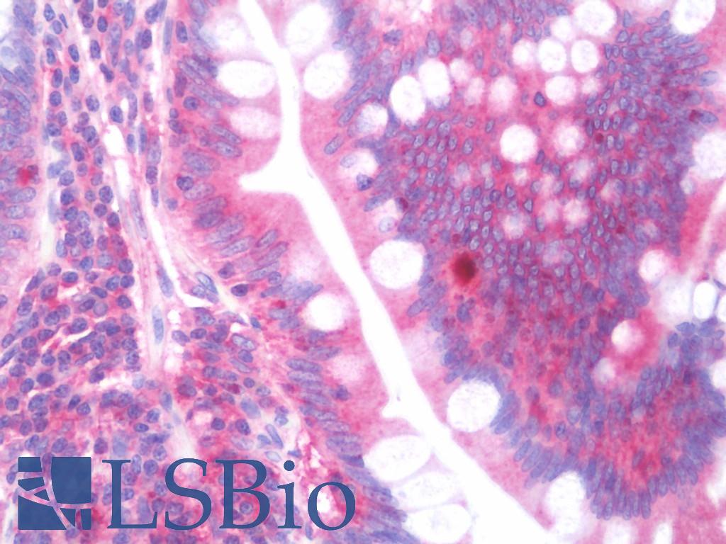 Ras-related protein Rab-4 (RAB4) Antibody - Anti-RAB4A / RAB4 antibody IHC staining of human small intestine. Immunohistochemistry of formalin-fixed, paraffin-embedded tissue after heat-induced antigen retrieval. Antibody concentration 10 ug/ml.