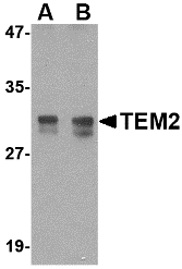 RASD2 Antibody - Western blot of TEM2 in rat colon tissue lysate with TEM2 antibody at (A) 1 and (B) 2 ug/ml. Below: Immunohistochemistry of TEM2 in human colon tissue with TEM2 antibody at 2.5 ug/ml.