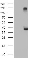 RASSF1 / RASSF1A Antibody - HEK293T cells were transfected with the pCMV6-ENTRY control (Left lane) or pCMV6-ENTRY RASSF1 (Right lane) cDNA for 48 hrs and lysed. Equivalent amounts of cell lysates (5 ug per lane) were separated by SDS-PAGE and immunoblotted with anti-RASSF1.