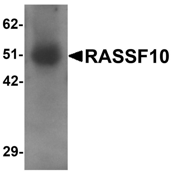 RASSF10 Antibody - Western blot analysis of RASSF10 in human lung tissue lysate with RASSF10 antibody at 1 ug/ml