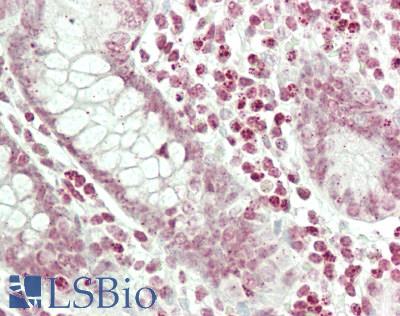 RASSF2 Antibody - Human Small Intestine: Formalin-Fixed, Paraffin-Embedded (FFPE)