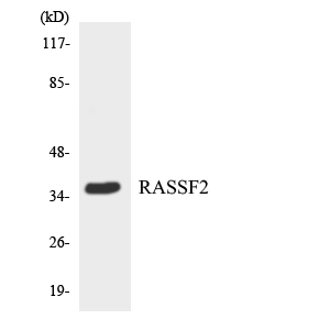 RASSF2 Antibody - Western blot analysis of the lysates from HepG2 cells using RASSF2 antibody.