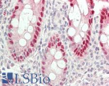 RAVER2 Antibody - Human Colon: Formalin-Fixed, Paraffin-Embedded (FFPE).  This image was taken for the unconjugated form of this product. Other forms have not been tested.