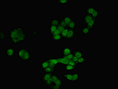 RAVER2 Antibody - Immunofluorescent analysis of PC-3 cells using RAVER2 Antibody at dilution of 1:100 and Alexa Fluor 488-congugated AffiniPure Goat Anti-Rabbit IgG(H+L)
