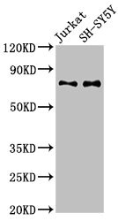 RAVER2 Antibody - Western Blot Positive WB detected in: Jurkat whole cell lysate, SH-SY5Y whole cell lysate All lanes: RAVER2 antibody at 3µg/ml Secondary Goat polyclonal to rabbit IgG at 1/50000 dilution Predicted band size: 75, 73 kDa Observed band size: 75 kDa