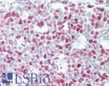 RB1 / Retinoblastoma / RB Antibody - Human Tonsil: Formalin-Fixed, Paraffin-Embedded (FFPE)