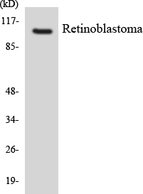 RB1 / Retinoblastoma / RB Antibody - Western blot analysis of the lysates from HeLa cells using Retinoblastoma antibody.