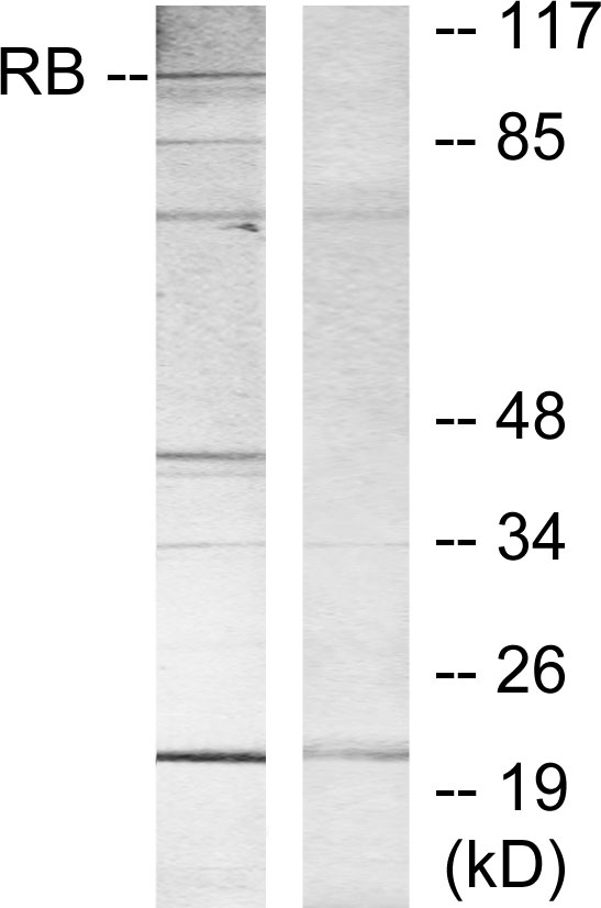 RB1 / Retinoblastoma / RB Antibody - Western blot analysis of lysates from MOLT cells, using Retinoblastoma Antibody. The lane on the right is blocked with the synthesized peptide.