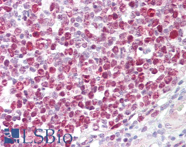 RB1 / Retinoblastoma / RB Antibody - Anti-RB1 antibody IHC of human tonsil. Immunohistochemistry of formalin-fixed, paraffin-embedded tissue after heat-induced antigen retrieval. Antibody dilution 1:200.
