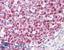 RB1 / Retinoblastoma / RB Antibody - Anti-RB1 antibody IHC of human tonsil. Immunohistochemistry of formalin-fixed, paraffin-embedded tissue after heat-induced antigen retrieval. Antibody dilution 1:200.